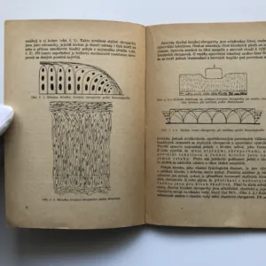 Deformační arthrosa, Jan Zahradníček