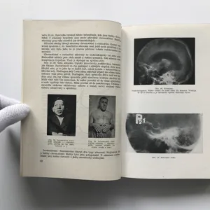 Speciální neurologie, Kamil Henner, Zdeněk Macek, Jiří Vítek