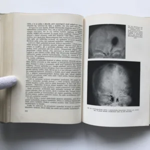 Speciální neurologie, Kamil Henner, Zdeněk Macek, Jiří Vítek