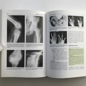 Klinická revmatologie, Karel Pavelka, Jozef Rovenský, kolektiv autorů